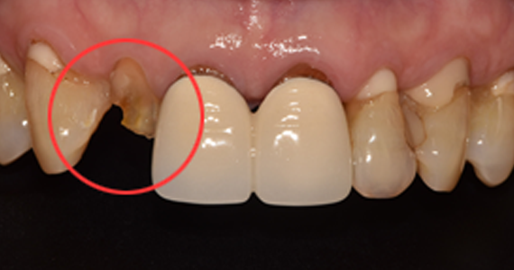 case2-1