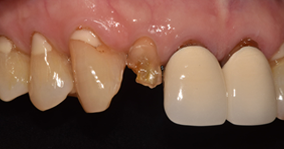 case2-2