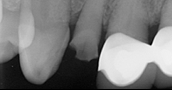 case2-3