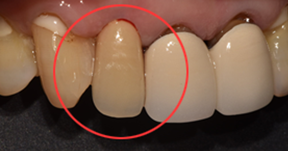 case2-4