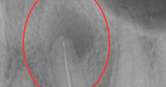 case2-2
