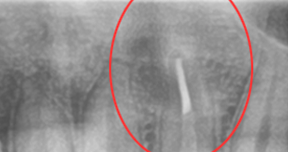 case2-3