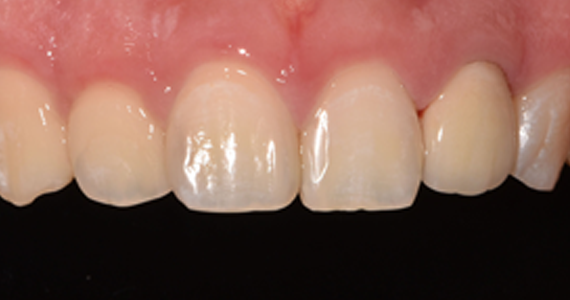 case2-4