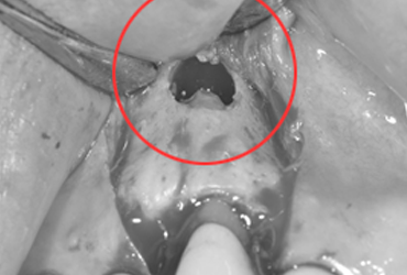 case2-2