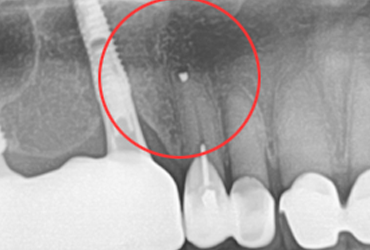 case2-3